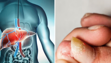 Photo of पैरों में नजर आते हैं लिवर डैमेज के एक नहीं 8 लक्षण