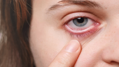 Photo of आंखों में दिखता है हाई ब्लड प्रेशर का पहला संकेत