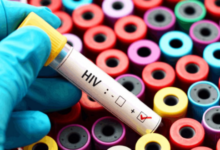 Photo of दिल्ली में एचआईवी के 60 हजार मरीज, राष्ट्रीय औसत से अधिक है राजधानी में प्रसार दर; पुरुषों की संख्या अधिक