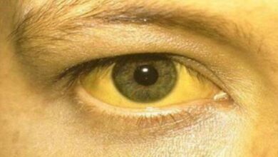 Photo of हरियाणा के इस जिले में 16 बच्चों में मिले पीलिया के लक्षण