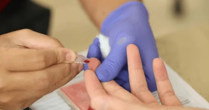 Photo of ऑस्ट्रेलिया की बड़ी खोज, हेपेटाइटिस बी की जांच अब होगी आसान