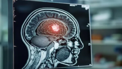 Photo of शरीर की ‘शुगर’ का इस्तेमाल करेक ताकतवर बन रहा ब्रेन ट्यूमर